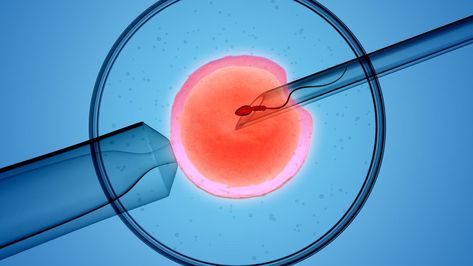 Monash IVF will likely call on expert embryologists to defend claims it incorrectly destroyed viable embryos, ending some women’s hopes of having children, a court has been told. Organizational Development, Ivf Cost, Forms Of Birth Control, Assisted Reproductive Technology, Ivf Baby, Ivf Clinic, Fertility Center, In Vitro Fertilization, Mang Thai