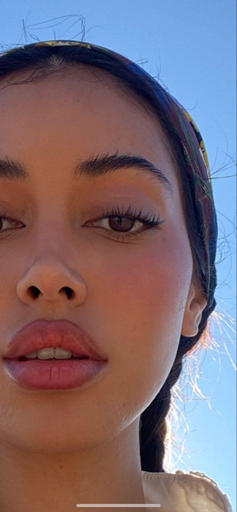 Cindy Kimberly Lip Fillers, Defined Nose Bridge, Button Nose Surgery, Slim Face Aesthetic Pictures, Keyhole Pout Lip Filler, Front Nose Profile, Big Pouty Lips, Keyhole Pout Lips, Lip Filler Pouty Lips