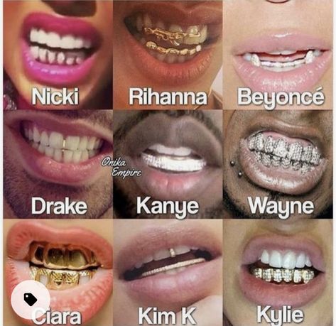 Gold Braces, Teeth Aesthetic, Pretty Teeth, Grillz Teeth, Cute Braces, Diamond Teeth, Tooth Gems, Braces Colors, Loose Tooth