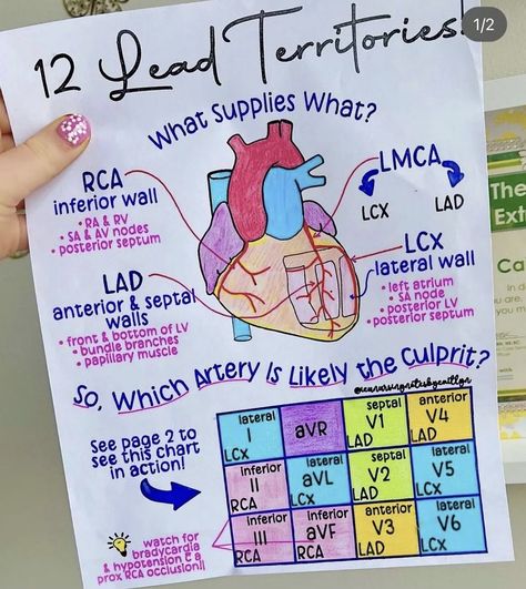 Cardiovascular Notes, Cath Lab Nursing, Cardiac Cath, Cardiology Nursing, Ekg Interpretation, Paramedic School, Nursing Board, Cardiac Nurse, Nursing School Essential