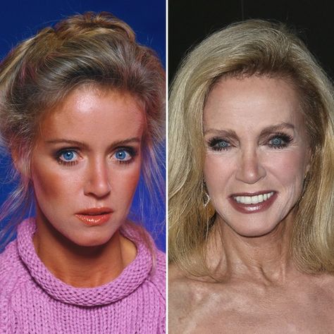 Saved Pictures, Donna Mills, Knots Landing, Bo Derek, Female Power, Celebrities Then And Now, Green Eye, Falling Stars, Old Love