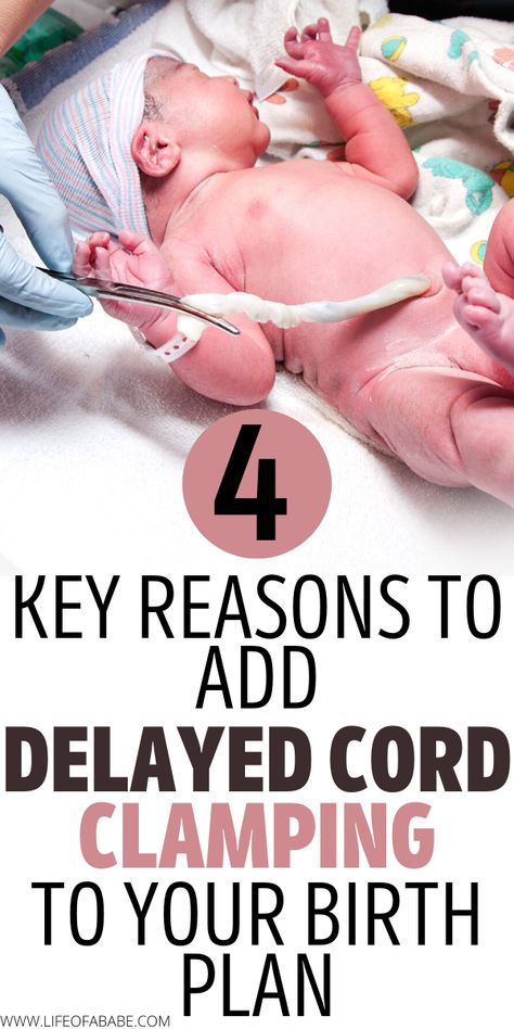 Cord Clamping Delayed, Birthing Plans, Natural Birth Tips, Labor And Delivery Tips, Birth Plan Examples, Natural Hospital Birth, Birthing Plan, Pregnancy Delivery, Delayed Cord Clamping