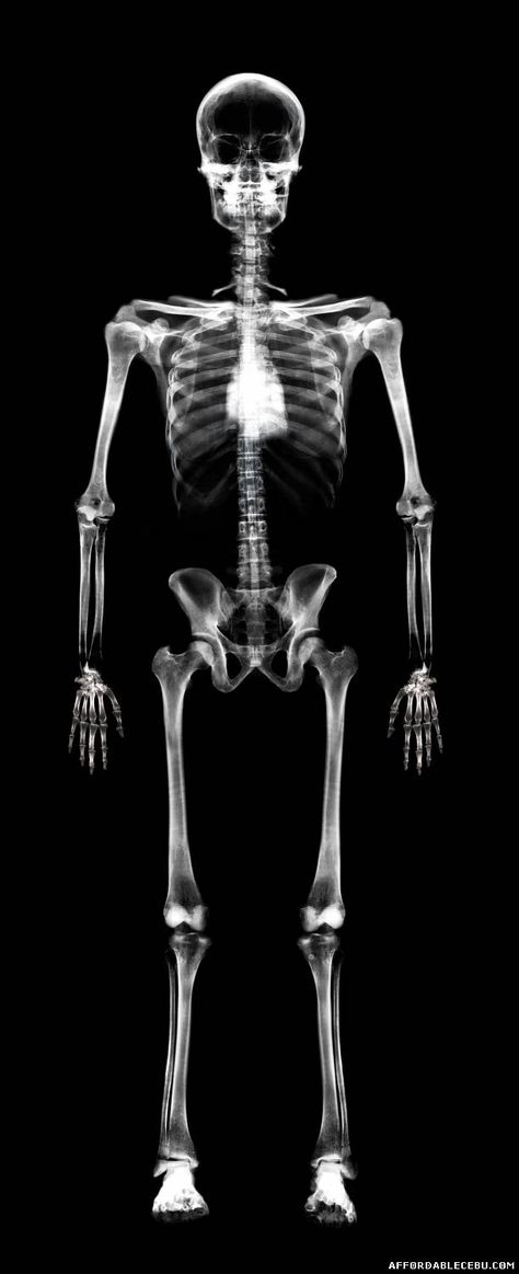 Downloadable Xray Art, Booth And Bones, Skeleton Body, George Melies, Bones Tv Show, Advanced Photoshop, Stronger Teeth, Black Background Wallpaper, Art Wallpaper Iphone