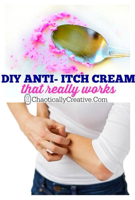 Diy Anti Itch Cream, Bug Bite, Anti Itch Cream, Itch Relief, Anti Itch, Bug Spray, Alternative Healing, Bug Bites, Diy Skincare