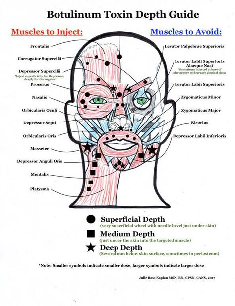 Bunny Lines Botox Units, Botox Vs Jeuveau, Starting A Botox Business, Botox Tips And Tricks, Botox Training For Nurses, Botox Studio Ideas, Cosmetic Nurse Injector, Dao Botox Injection, Botox And Brunch Party