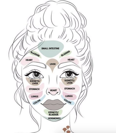 Wondering if there is a connection between acne and each organ in your body? There is! ✨- map of acne on face - face acne map - face acne chart - face acne meaning - map of acne on face - skincare routine - skincare tips - #skincare #acne Face Acne Remedies, Acne Chart, Best Acne Scar Removal, Face Map, Skin Mapping, Facial Massage Roller, Face Skin Care Routine, Face Mapping, Acne Scar Removal