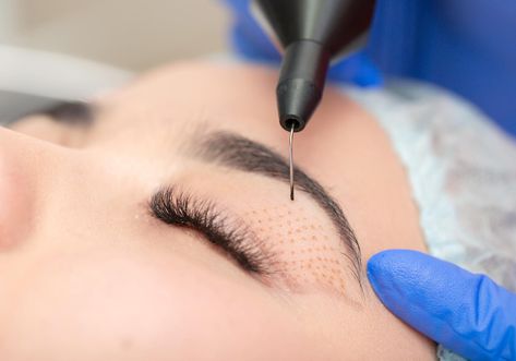 Botox Brow Lift, Drooping Eyelids, Permanente Make-up, Droopy Eyelids, Fractional Laser, Eyelid Lift, Upper Eyelid, Facial Rejuvenation, Skin Resurfacing