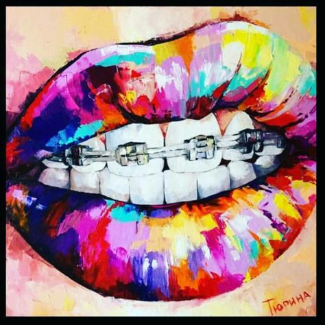 Brace face Dental Wall Art, Dental Wallpaper, Dentist Art, Dental Posters, Dental Office Design Interiors, Teeth Art, Dental Office Decor, Dental Facts, Dental Design