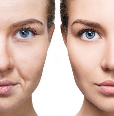 Stop the effects of ageing before it gets the best of us, with a plan of attack that includes treatments & procedures that make a difference. #SkinOnline #SkinOnlineBlog #ageing #TopTreatments #BeautyTips #SkinTips #tricks #treatments #Laser #injectables Medical Spa, Face Yoga, Dermal Fillers, Dermatology, Skin Rejuvenation, Beauty Treatments, Plastic Surgery, Woman Face, Surgery