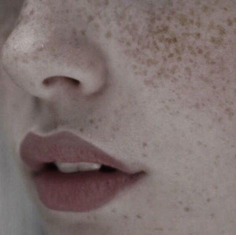 Pale Skin With Freckles, Pale Freckled Skin, Beauty Mark Aesthetic, Freckled Skin, Pyper America Smith, Kim Possible, Pale Skin, Tan Skin, Bern