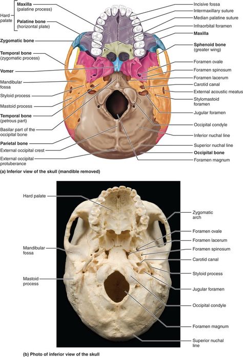 PART 1 THE AXIAL SKELETON - 7.1 The skull consists of 8 cranial bones and 14 facial bones: Human Anatomy and Physiology Cranial Bones, Bones Human, Axial Skeleton, Facial Bones, Anatomy Bones, Skull Anatomy, Basic Anatomy And Physiology, Dental Hygiene School, Dental Anatomy