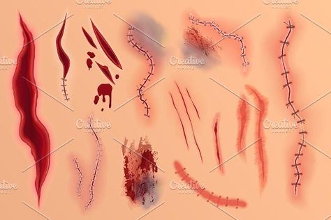 Open Wounds Drawing Reference, Open Wound Reference Drawing, Wound Reference, Scar Ideas, How To Draw Scars, Surgical Stitches, Skin Background, Drawing Blood, 3d Structure