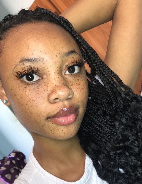 Clear Freckled Skin, Freckles Black Women, Black Woman With Freckles, Freckles On Dark Skin, Faux Freckles Makeup, Freckle Makeup, Dark Freckles, Black Girls With Freckles, Black Freckles