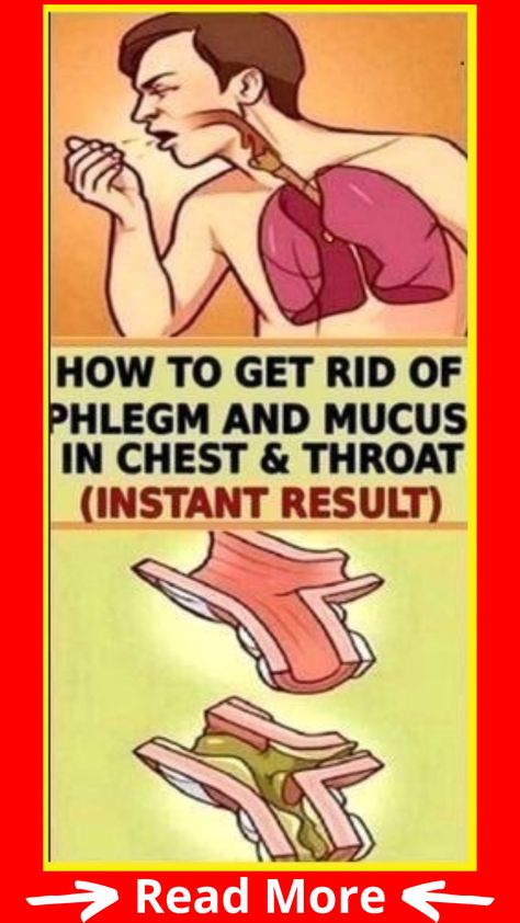 HOW TO GET RID OF PHLEGM AND MUCUS IN CHEST & THROAT (INSTANT RESULT) Phlegm In Throat, Mucus In Chest, Get Rid Of Mucus, Getting Rid Of Mucus, Getting Rid Of Phlegm, Get Rid Of Cold, Health Signs, Fitness Articles, Lose 40 Pounds