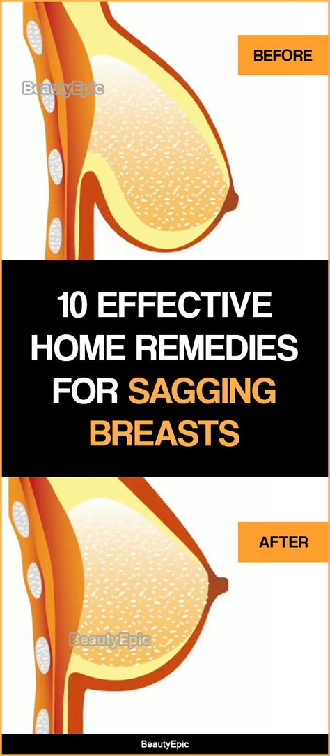 Skin Care Remedies, Nordic Walking, Sagging Breast, Home Remedies For Bronchitis, Breast Lift Exercise, Breast Workout, Home Health Remedies, Breast Health, Breast Lift