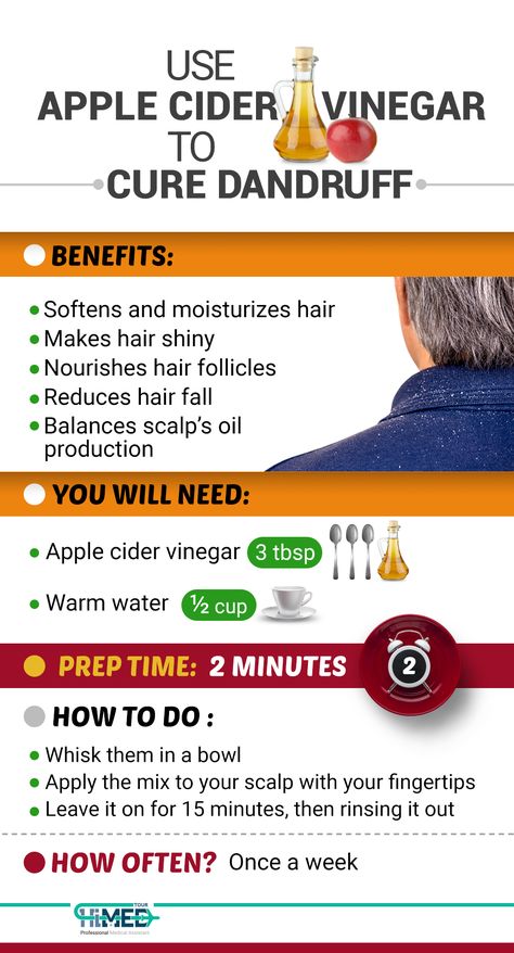 Vinegar For Dandruff, Natural Dandruff Remedy, Hair Mask For Dandruff, Dandruff Solutions, Vinegar For Hair, Rid Of Dandruff, Apple Cider Vinegar For Hair, Homemade Hair Treatments, Hair Mask Recipe