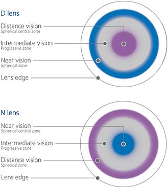 The New Biofinity Multifocal Fitting Guide - Eyedolatry Ophthalmic Assistant, Human Skeletal System, Multifocal Lenses, Eye Anatomy, Skeletal System, Old Technology, Bifocal Glasses, Dry Eyes, Skeletal