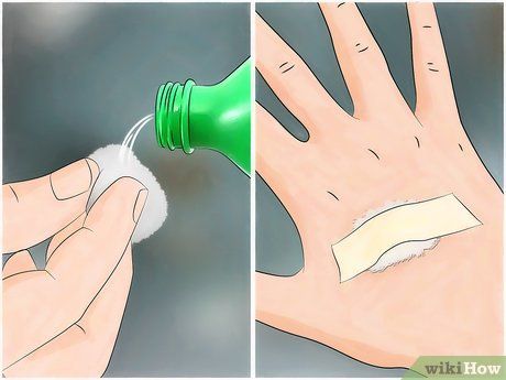 3 Ways to Reduce the Pain of Gnat Bites - wikiHow Gnat Bites, Bite Relief, Tree Sap, Bug Bites, Flying Insects, Body Of Water, Insects