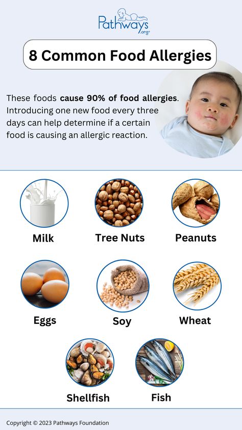 What are common food allergies you should look out for when introducing your child to new foods? Remember, introducing one new food every three days can help determine if a certain food is causing an allergic reaction. #kidallergies #foodallergies #allergies #babycare #babydevelopment #babyfood Baby Food Allergies, Common Food Allergies, Communication Development, Starting Solids, New Food, Early Intervention, Allergic Reaction, Baby Development, Child Development