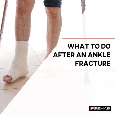 What To Do After An Ankle Fracture Ankle Exercises After Surgery, Fractured Ankle Recovery, Broken Ankle Recovery Tips, Ankle Fracture Recovery, Broken Fibula, Fractured Ankle, Ankle Surgery Recovery, Ankle Rehab Exercises, Broken Ankle Recovery