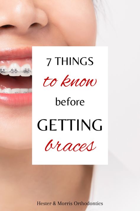 What To Expect When Getting Braces, Braces Tips First Week, Getting Braces On, Overbite Braces, Braces Aesthetic, Different Types Of Braces, Braces Before And After, After Braces, Braces Pain