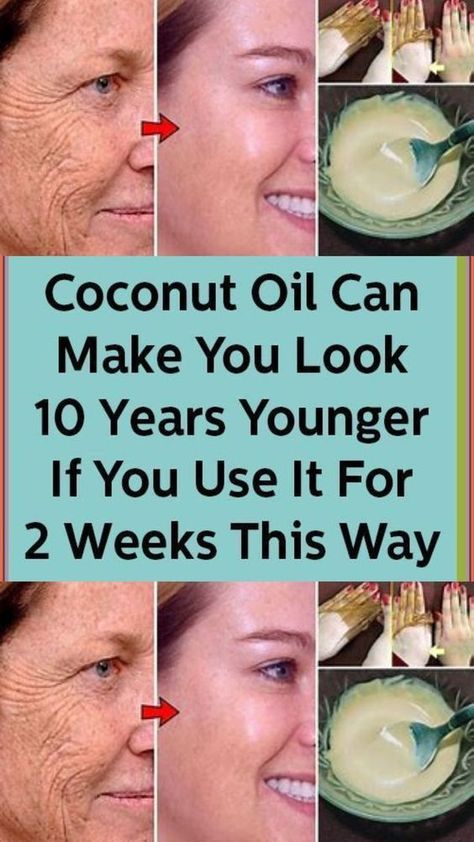 Coconut Oil Can Make You Look 10 Years Younger If You Use It For 2 Weeks This Way#howtoremovewrinklesfromfaceathome #removewrinkles #wrinkles #getridofwrinklesonface #howtogetridofwrinklesonface #removewrinklesonface Wrinkles Remedies Face, Wrinkle Remedies, Coconut Oil Skin Care, Wrinkle Free Skin, Forehead Wrinkles, Skin Care Wrinkles, Coconut Oil For Skin, Saggy Skin, Face Wrinkles