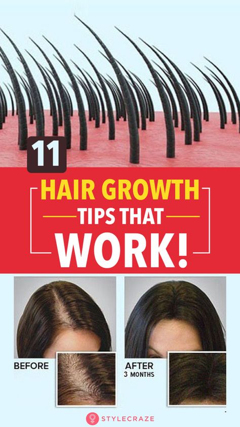 Before your dull and thinning hair could get any worse, it’s time to take action.All it takes is regular care and some handy tips that will set it right. Check out the tips mentioned below to make your hair long and thick. #Hair #HairCare #ThickHair Indian Hair Growth Secrets, Thicker Hair Naturally, Beauty Hacks That Actually Work, Grow Thicker Hair, Get Thicker Hair, Healthy Natural Hair Growth, Natural Hair Growth Tips, Hair Growth Secrets, How To Grow Your Hair Faster