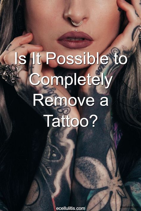 Is it possible to remove an entire tattoo? The answer is yes, but not every time. Let’s take a look at the factors that play a role in the tattoo removal process. At Home Tattoo Removal, Tatto Designs, Positivity Tattoo, Tattoo Removal Cream, Button Tattoo, Deep Tattoo, Tattoo Removal Cost, Faded Tattoo, Beginner Tattoos