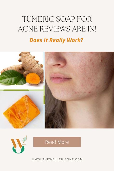 Tumeric Soap For Acne Reviews Are In! Does It Really Work? Clear Up Acne, Turmeric Soap, Ancient Egyptians, Ayurvedic Medicine, Natural Health, Health And Wellness, Medicine, Soap, Acne