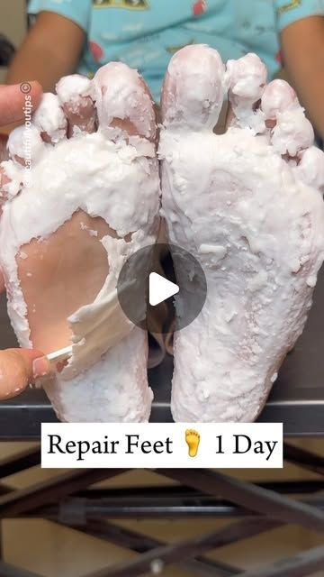 How To Soften Feet At Home, How To Get Rid Of Wrinkles On Hands, Dry Skin On Feet Removal Diy, Calloused Feet Remedy, Soft Feet Remedy At Home, Soft Hands Tips, Dry Cracked Feet Remedy, Cracked Heel Remedy, Cracked Feet Remedies