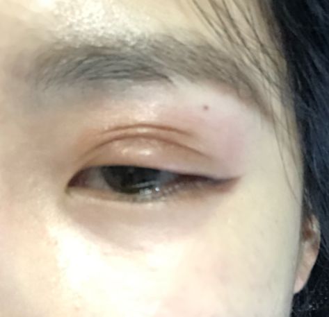 [200706] Yuju's swollen eye (Weverse) Swollen Eye, Swollen Eyes, Eyeliner