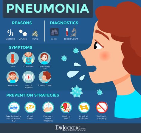 Pneumonia Remedies, Remedy For Sinus Congestion, Pneumonia Causes, Pneumonia Symptoms, Home Remedies For Sinus, Home Remedies For Bronchitis, Best Cough Remedy, Natural Decongestant, Sinus Infection