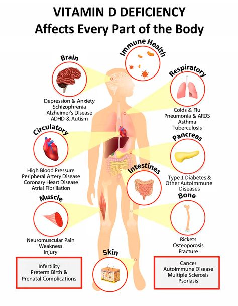 Interactive PDF: How Vitamin D Deficiency Affects Every Part of the Body - GrassrootsHealth Autoimmune Disease, Vitamin D Deficiency Symptoms, Vitamin D Supplement, Vitamin Deficiency, Vitamin D Deficiency, Vitamin D3, Immune Health, The Human Body, Vitamin D