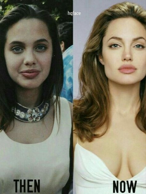 Did Angelina Jolie ever say anything about plastic surgery? Angelina Jolie Modeling, Angelina Jolie Surgery, Angelina Jolie Nose, Angelina Jolie Plastic Surgery, Celebs Without Makeup, Angelina Jolie Photos, Celebrity Plastic Surgery, Celebrities Then And Now, Celebrities Before And After