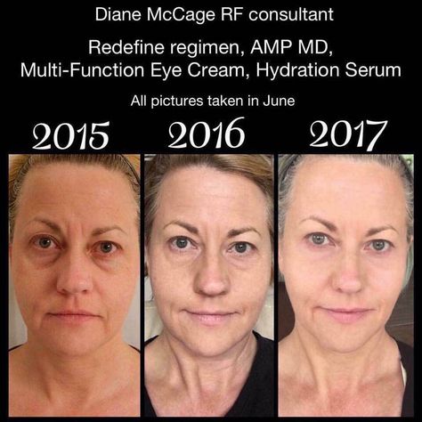 Aging backwards?! #RedefineAging #RealResults Rodan Fields Skin Care, Turn Down For What, Redefine Regimen, Rodan And Fields Redefine, Aging Backwards, Life Changing Skincare, Acne Cleansers, Anti Aging Wrinkles, Anti Aging Tips