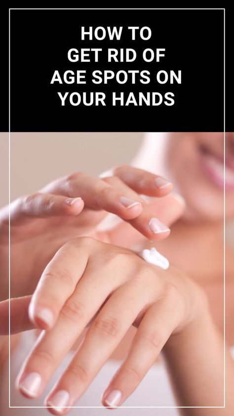 To get rid of age spots on your hands here are some of the processes you can try. Get Rid Of Age Spots, Remove Skin Tags Naturally, Baking Soda For Hair, Tips For Oily Skin, Dark Spots On Face, Skin Natural Remedies, Natural Sleep Remedies, Spots On Face, Baking Soda Shampoo