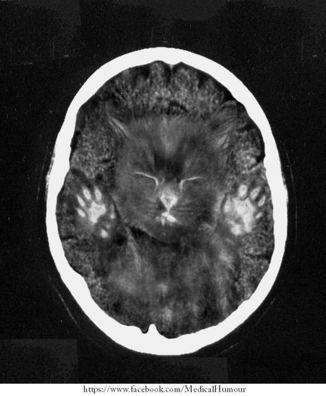 CAT scan...had to share this from a CT tech's post....too funny!!! Mri Humor, Medische Humor, Medical Coding Humor, Xray Humor, Radiology Humor, Coding Humor, Cat Scan, Brain Scan, Medical Imaging