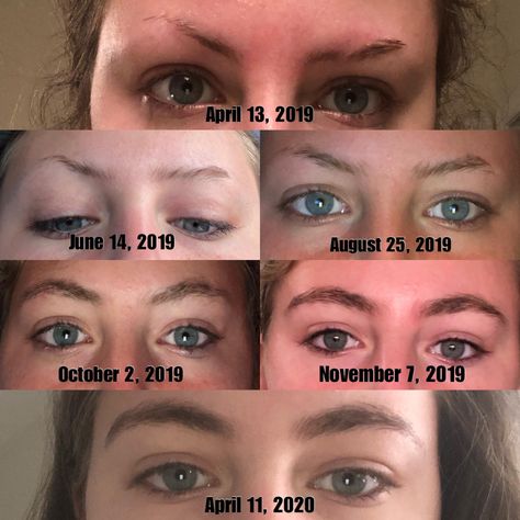 Thick Eyebrows Natural, Darken Eyebrows, Growing Out Eyebrows, Eyebrow Hair Growth, Long Eyebrows, Big Eyebrows, Hair Growth Rate, Grow Eyebrows Thicker, Eyebrow Before And After