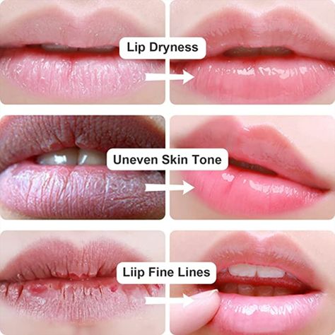 Permotary 30 PCS Moisturizing Lip Mask Crystal Lip Care Pads Mask for Moisturizing & Reducing Chapped, Smoothing Lip Fine Lines-Lip Patches with Moisture Essence to Firms & Hydrate and Plump Your Lips Collagen Lip Mask, Lip Masks, Lip Patch, Lip Jelly, Crystal Lips, Lip Care Routine, Lip Wrinkles, Skin Care Clinic, Smooth Lips