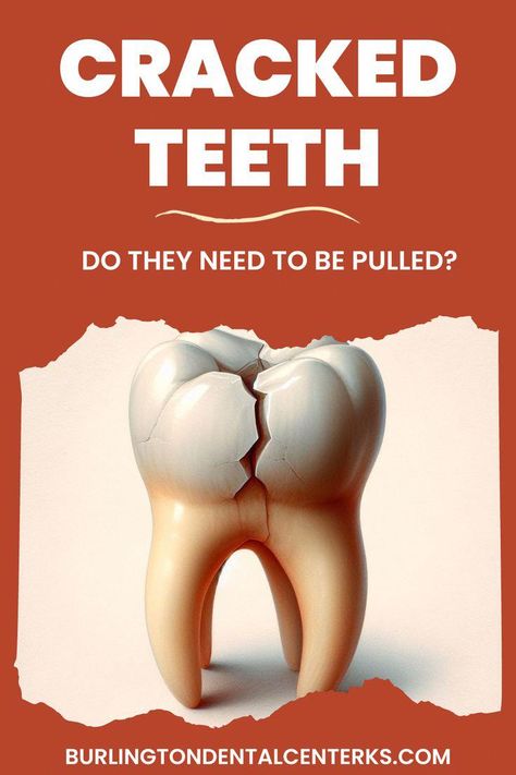 Cracking a tooth is an ominous feeling. But don't panic just yet -- we'll give you a better idea of whether or not your cracked tooth needs to be pulled or saved. #PreventiveOralHealthCare Milk Soap Recipe, Cracked Tooth, Tooth Decay Remedies, Dental Tips, Caring Meaning, Soap Recipe, What Is Meant, Oral Health Care, Dental Hygiene