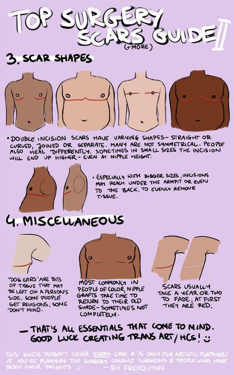 Top Surgery Scars, Top Surgery, Trans Art, Trans Boys, Losing 40 Pounds, Cold Sores Remedies, Lose 40 Pounds, Body Reference, Drawing Poses