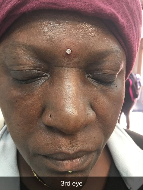 Dermal on forehead. 3rd eye Forehead Dot Tattoo, Forehead Dermal, Forehead Piercing, Facial Dermal Piercing, Piercing Neck, Dermal Piercing Chest, Eye Dermal, Anti Eyebrow, Spider Bite Piercing