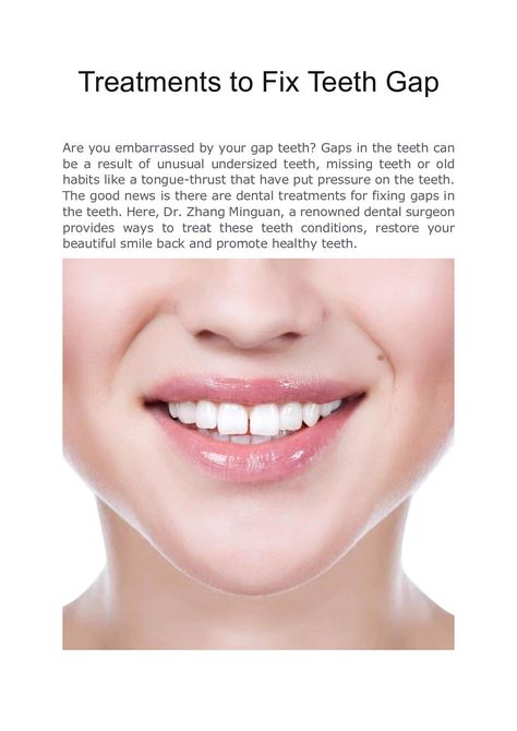 Dr Zhang Minguan- Treatments to Fix Teeth Gap now on Teeth Gap, Tongue Thrust, Fix Teeth, Quotes Psychology, Dental Surgeon, Gap Teeth, Beauty Diet, Physical Appearance, Therapy Counseling