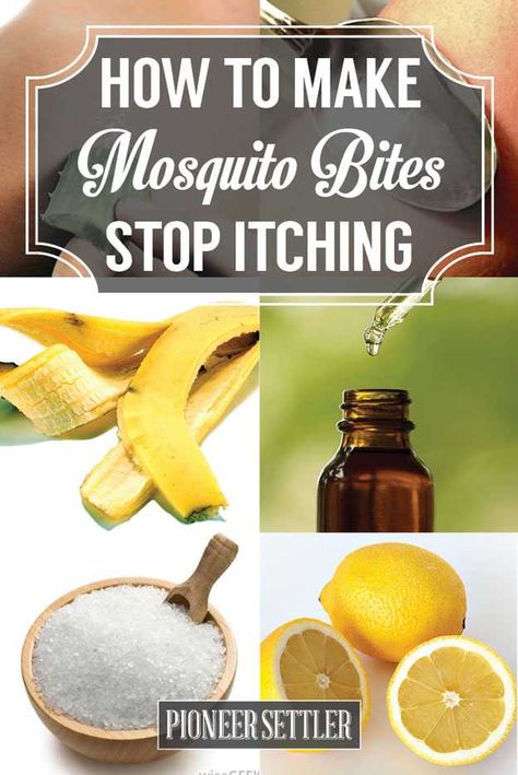 Mosquito Bites Stop Itching, Remedies For Mosquito Bites, Mosquito Bites, Natural Healing Remedies, Mosquito Bite, Homemade Remedies, Natural Home Remedies, Back To Nature, Natural Home