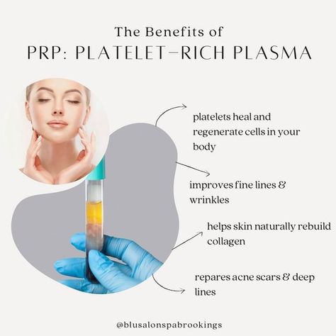 Blu Salon + Spa on Instagram: "Why you should get PRP! 💙" Spa Things, Medical Spa Marketing, Med Spa Marketing, Spa Marketing, Derma Pen, Girl Aesthetics, Platelet Rich Plasma, Jewel Wedding, Instagram Ideas Post