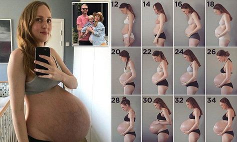 Mother pregnant with TRIPLETS shares extraordinary week-by-week photos Triplet Baby Bump, Twin Belly Progression, Twin Bump Progression, 3 Month Baby Bump, 30 Weeks Pregnant Belly, 3 Months Pregnant Belly, Pregnant With Triplets Belly, 4 Months Pregnant Belly, Multiples Pregnancy