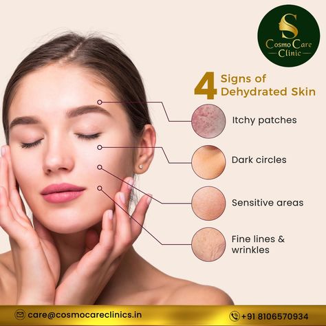 Not sure if your skin is struggling with dehydration? Well here are 4 signs which show that you have dehydrated skin!!! If your skin is showing these signs then cosmo care is here to help! Book your appointment and get a consultation before time runs out! Call Us :8106570934 #cosmocareclinic #skinwhiteningtreatment #skintreatmentent #beauty #beautyclinic #skin #hair #hyderabad Skin Care Center, Social Media Branding Design, Instagram Prints, Beauty Clinic, Cosmetic Skin Care, Dehydration, Itchy Skin, Book Your Appointment, Dehydrated Skin