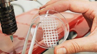 Tissue Engineering, Survey Report, Human Body Parts, Biomedical Engineering, Materials Science, Dental Surgery, Medical Devices, Dermal Fillers, Marketing Professional