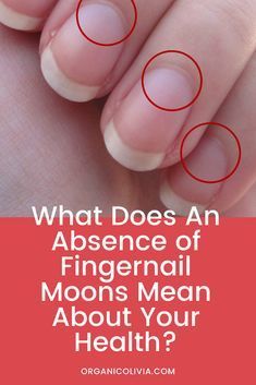 Natural Health Tips, Nail Health Signs, Fingernail Health Signs, Fingernail Health, Moon Meaning, Health Signs, Tongue Health, Thyroid Health, Nail Health