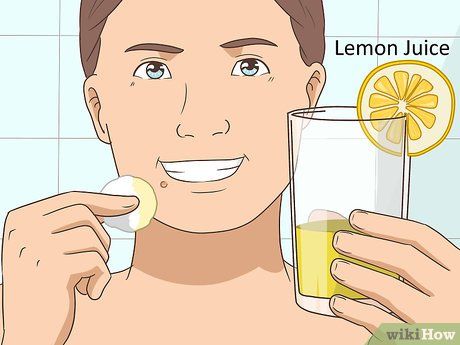 3 Ways to Remove Facial Warts - wikiHow Face Warts, Flat Warts, Types Of Warts, Facial Warts, Warts On Face, Home Remedies For Warts, Remove Skin Tags Naturally, Warts Remedy, Remove Warts